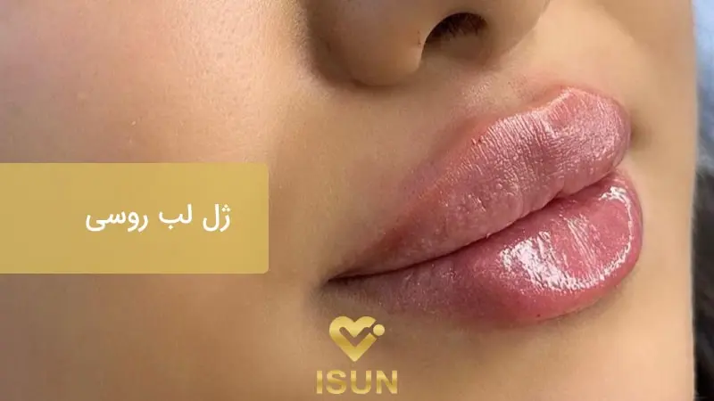 ژل لب