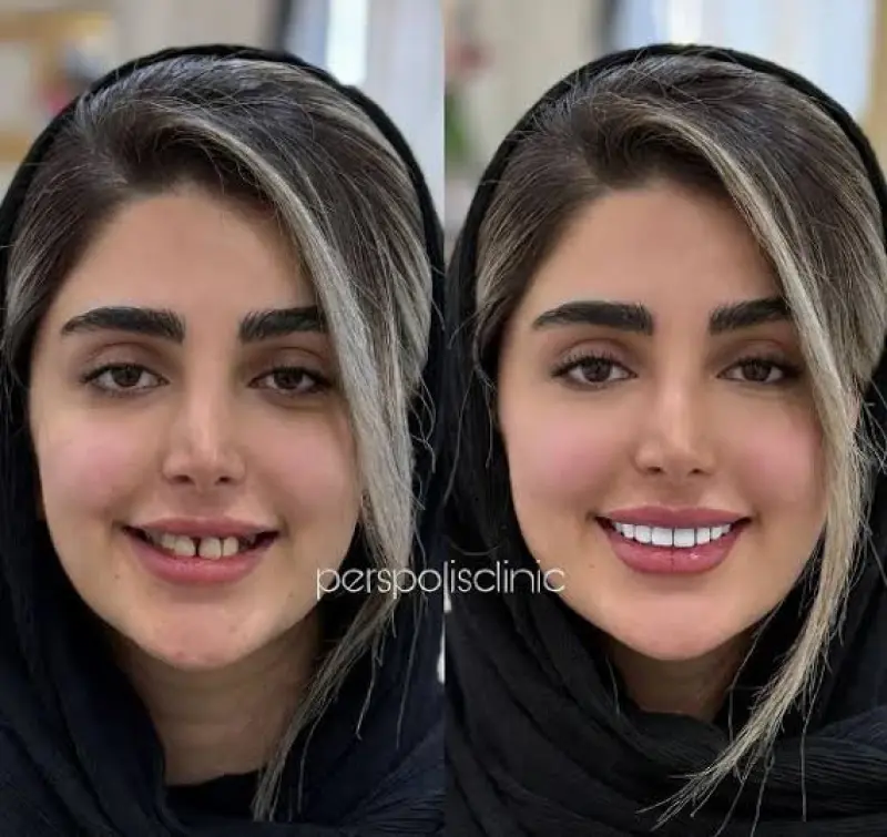 کامپوریت