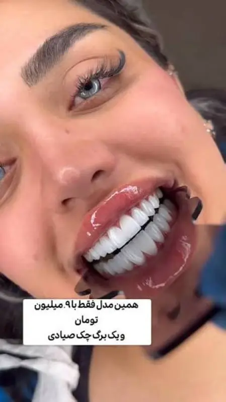 کامپوریت