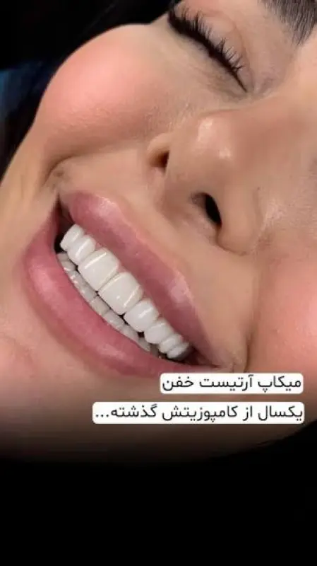 کامپوریت